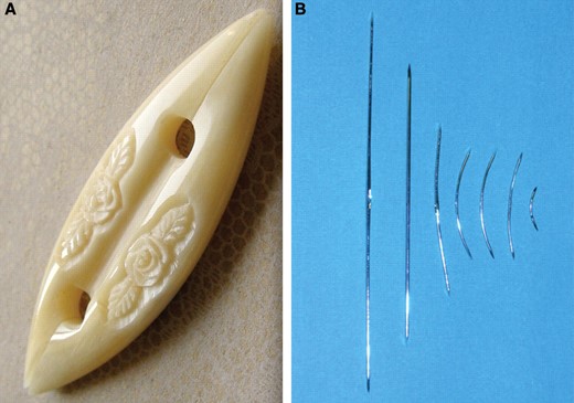 Figure 1 - The traditional shuttle (A) and its surgical alteration (B).