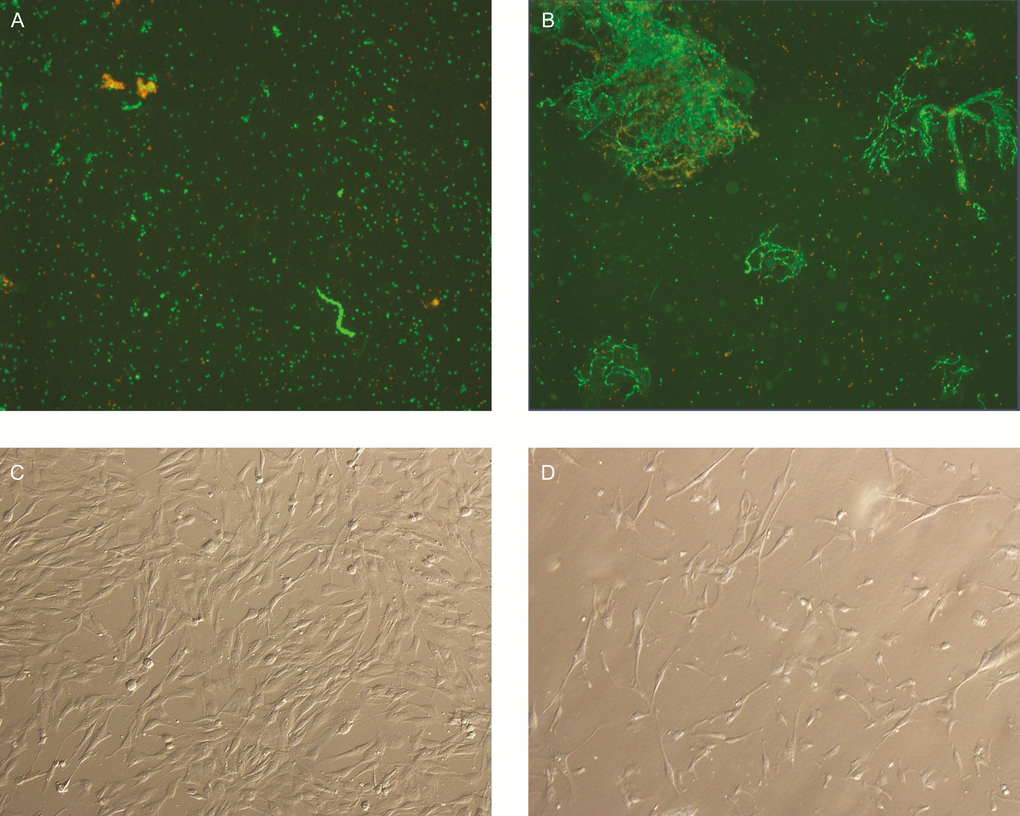 Figure 1. Microscopy images of cell-stained cocktails obtained after mechanical isolation and enzymatic isolation. Cell counts and cell viabilities were measured by laser-based fluorescence detection with a Muse flow cytometer (Merck Millipore, Germany). (A) Fluorescence microscopy of E-SVF. (B) Fluorescence microscopy of M-SVF. (C) Cell culture image of E-SVF by phase-contrast microscopy at ×40 magnification. (D) Cell culture image of M-SVF by phase-contrast microscopy at ×40 magnification.